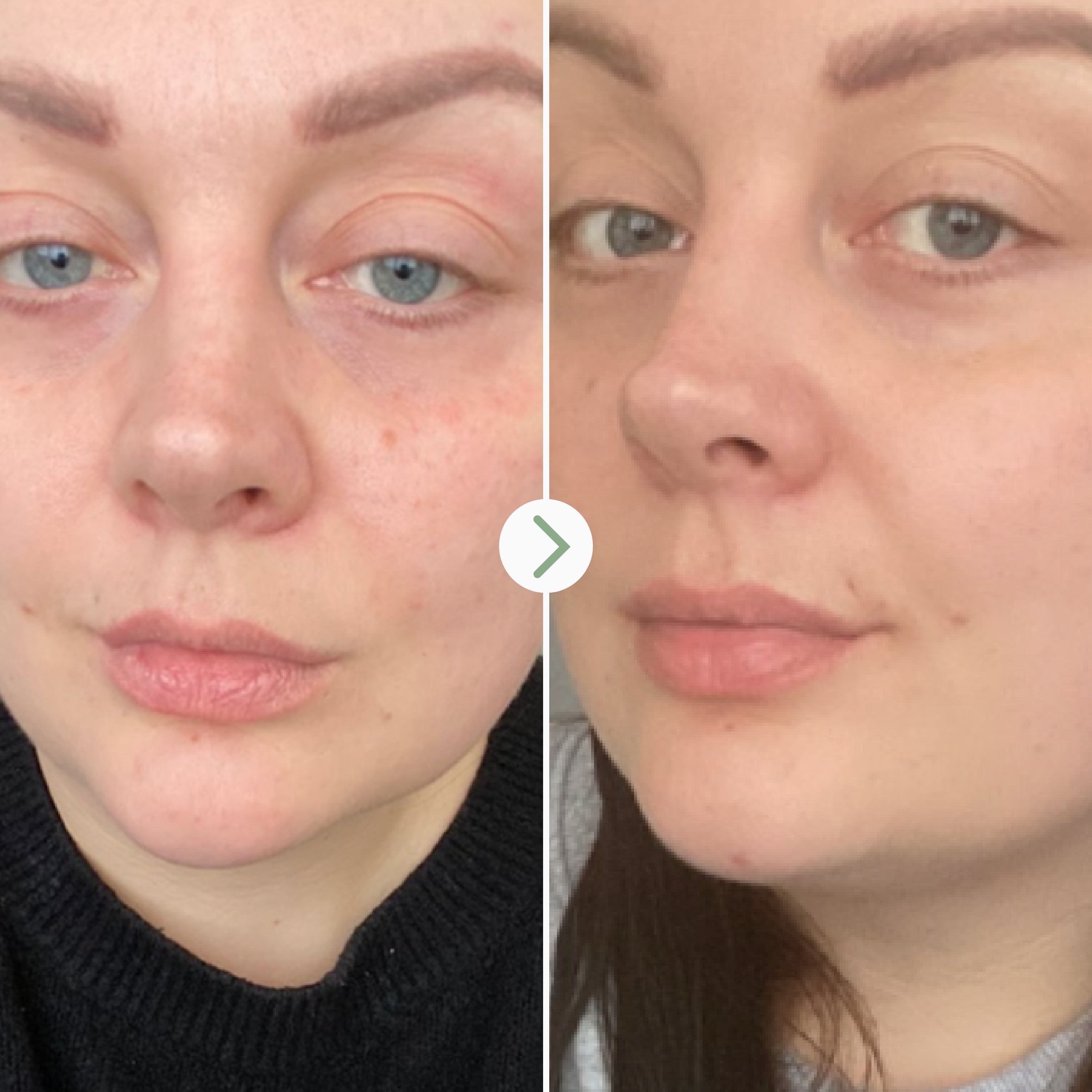 Óleo facial de rosehip Bioregenerate
