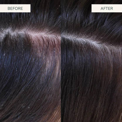 Scalp Exfoliating Shampoo